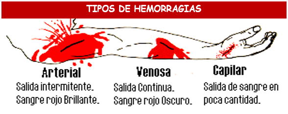 tipos de hemorragias externas