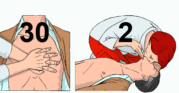 compresiones e insuflaciones